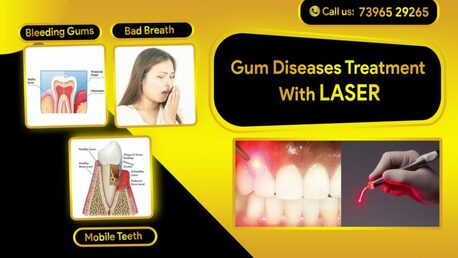 Hyderabad, Dental, Effective Gum Disease Treatment For Healthy Teeth And Gums
