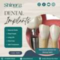 Dental Implants In Ahmedabad For Better Chewing And Natural Appearance
