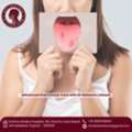 Professional Guidance By Best Oral Cancer Surgeon Ahmedabad - Dr Natasha Lalwani