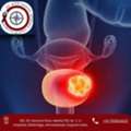 Advanced Bladder Cancer Treatment In Ahmedabad &ndash; Dr. Nitin Singhal