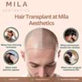 Best Hair Transplant In Ahmedabad With Mila Aesthetics