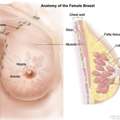 Breast Cancer Treatment Singapore: Novena Cancer Centre