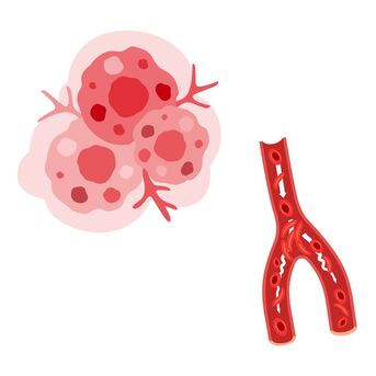 Mumbai, Health, Sickle Cell Disease Treatment In India For Kenyan Patients