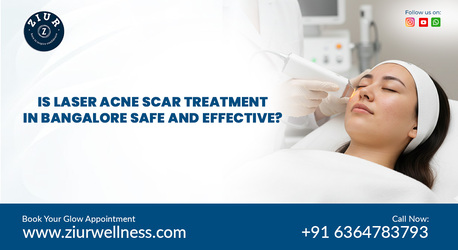 Dubai, Business, Best Acne Scar Treatment Near Me In Bangalore
