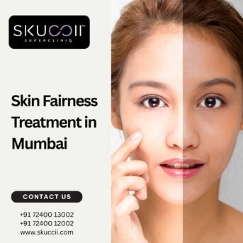 Mumbai, Health, Skin Fairness Treatment In Mumbai For Radiant, Even-Toned Skin