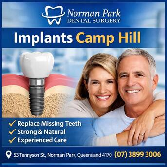 Sydney, Dental, Implants Camp Hill &ndash; Long-Term Tooth Replacement By Local Dental Professionals