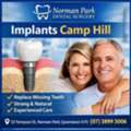 Implants Camp Hill &ndash; Long-Term Tooth Replacement By Local Dental Professionals