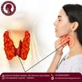 Leading Thyroid Cancer Care Surgeon In Ahmedabad - Dr Natasha Lalwani