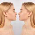 Nose Surgery In Cape Town &ndash; Expert Rhinoplasty For Natural, Confident Results