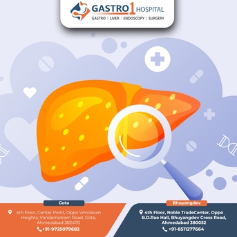 Ahmedabad, Health, Gastro1 Hospital - Liver Transplant In Ahmedabad With Advanced Technology