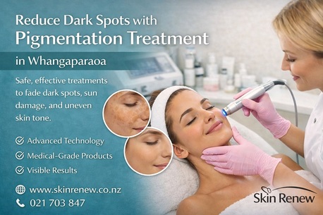 Auckland, Health, Reduce Dark Spots With Pigmentation Treatment In Whangaparaoa