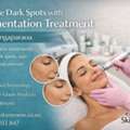 Reduce Dark Spots With Pigmentation Treatment In Whangaparaoa
