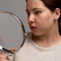 Effective Pigmentation Treatment In Dubai &ndash; Reveal Clearer Skin