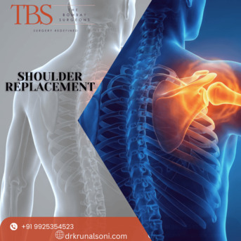 Ahmedabad, Health, Shoulder Replacement Surgeon In Ahmedabad With Dr. Krunal Soni