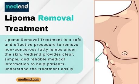 Mumbai, Health, Lipoma Surgery: Safe & Permanent Treatment