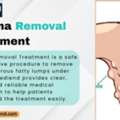 Lipoma Surgery: Safe & Permanent Treatment