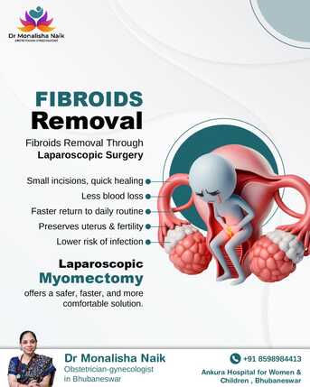 Mumbai, Health, Laparoscopic Fibroid Surgery | Dr. Monalisha Naik, Bhubaneswar