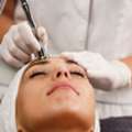 Microdermabrasion Treatments