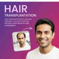No.1 Hair Transplant Clinic In Hyderabad For Men & Women