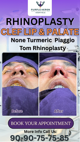 Jaipur, Health, Best Plastic Surgeon In Jaipur