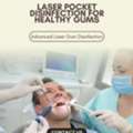 Comfortable, Effective Laser Gum Disinfection