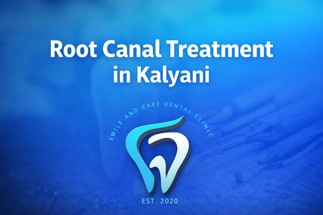 Mumbai, Health, Root Canal Treatment In Kalyani &ndash; Smile & Care Dental Clinic