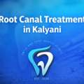 Root Canal Treatment In Kalyani &ndash; Smile & Care Dental Clinic