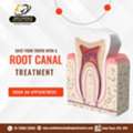 What Is The Minimum Cost For Root Canal Treatment In Sainikpuri?