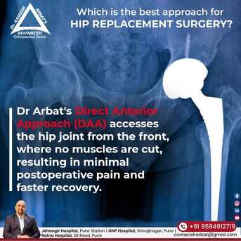 Pune, Health, Best Robotic Hip Replacement Doctor In Pune  - Dr. Aashish Arbat