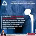 Best Robotic Hip Replacement Doctor In Pune  - Dr. Aashish Arbat
