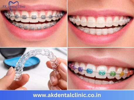 Mumbai, Dental, Advanced Dental Clinic In Juhu | Expert Care - AK Dental Clinic