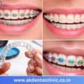 Advanced Dental Clinic In Juhu | Expert Care - AK Dental Clinic