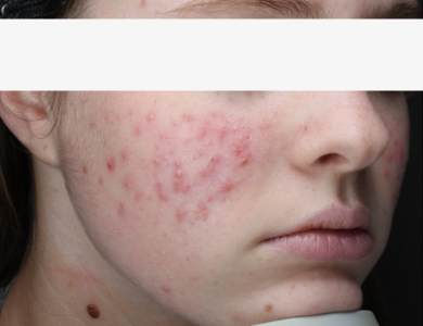 New York, Health, Gentle Daily Cleanser For Clearer Skin