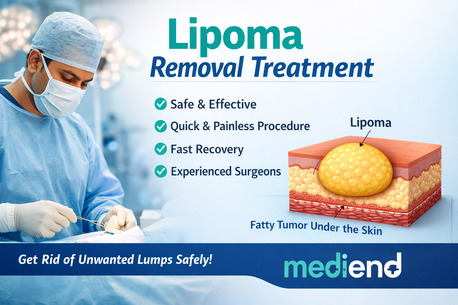 Mumbai, Health, Lipoma Treatment In Delhi: Causes, Symptoms & Removal Options