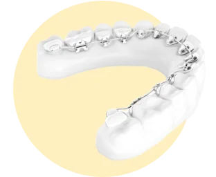 London, Dental, Clear Invisalign Aligners In Bristol &ndash; Comfortable, Invisible Smile