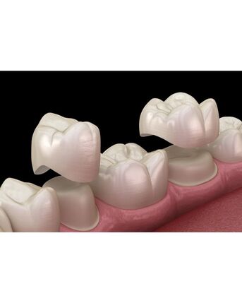 New York, Business, Dental Crowns In Rockland County, NY