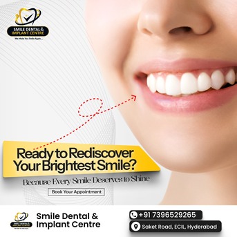 Hyderabad, Dental, How Much Is The Price For Cleaning Teeth? | Dental Doctor Near Me