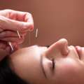 Best Acupuncture Clinic In Hollywood, FL &ndash; Drug-Free Pain Solution