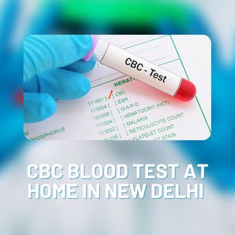 New Delhi, Health, CBC Test Price In New Delhi &ndash; Home Sample Collection