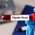 Nipah Virus Explained: Causes, Symptom And Prevention