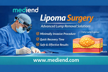 Mumbai, Health, Lipoma Surgery: Advanced Lump Removal Option