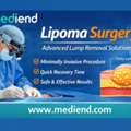 Lipoma Surgery: Advanced Lump Removal Option