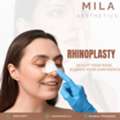 Mila Aesthetics| Rhinoplasty In Ahmedabad For Natural-Looking Results