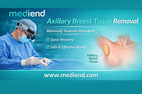Mumbai, Health, Axillary Breast  Advanced Underarm Tissue Removal