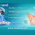 Axillary Breast  Advanced Underarm Tissue Removal