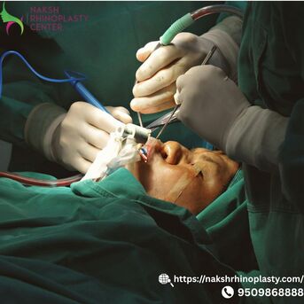 Jaipur, Health, Advanced Nose Surgery For Functional & Cosmetic Needs