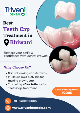 Haryana, Dental, Best Teeth Cap (Crown) Treatment In Bhiwani | Triveni Dental