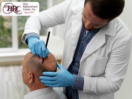 Los Angeles, Health & Beauty Items, Male Wig Installation Los Angeles For Hair Loss