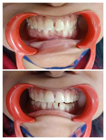 Mumbai, Health, Dentist In Dwarka Sector 19