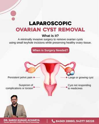Mumbai, Health, Laparoscopic Ovarian Cyst Removal &ndash; Dr. Saroj Kumar Acharya, Bhubaneswar